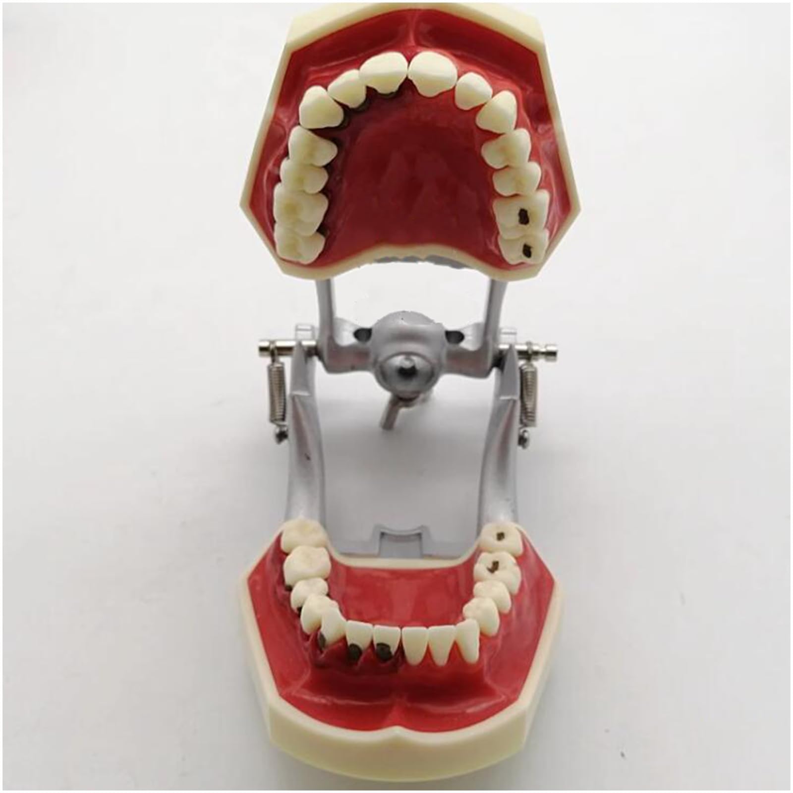 Dentales Zahnmodell für pathologische Parodontitis - Abnehmbares Zahnmodell für pathologische Zahnfleischerkrankungen - zur Kommunikation zwischen Arzt und Patient