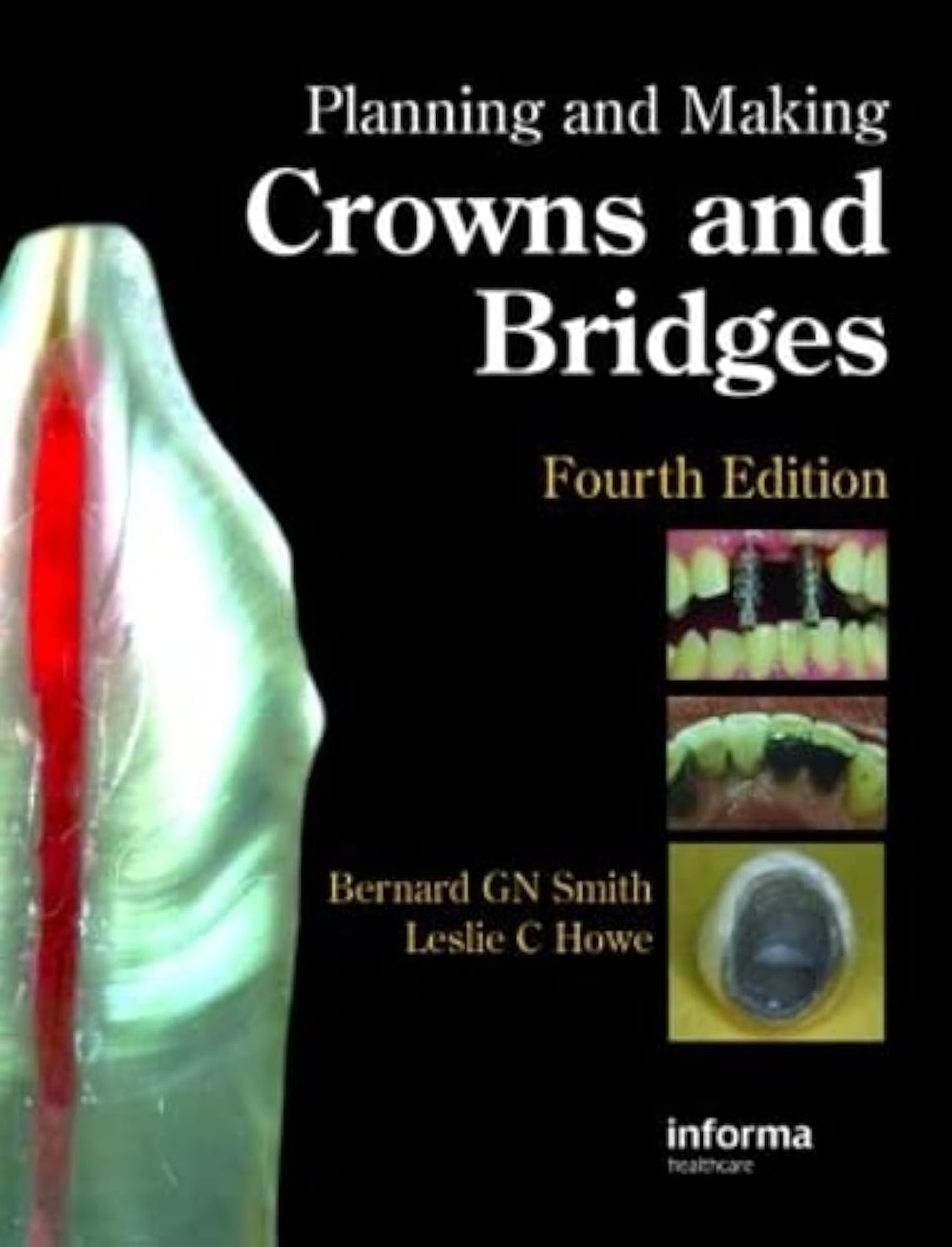 Buy (Ex)Planning And Making Crowns And Bridges — BookShops.in