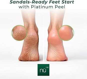 Amazon.com: nu119 Platinum Instant Foot Peeling Spray