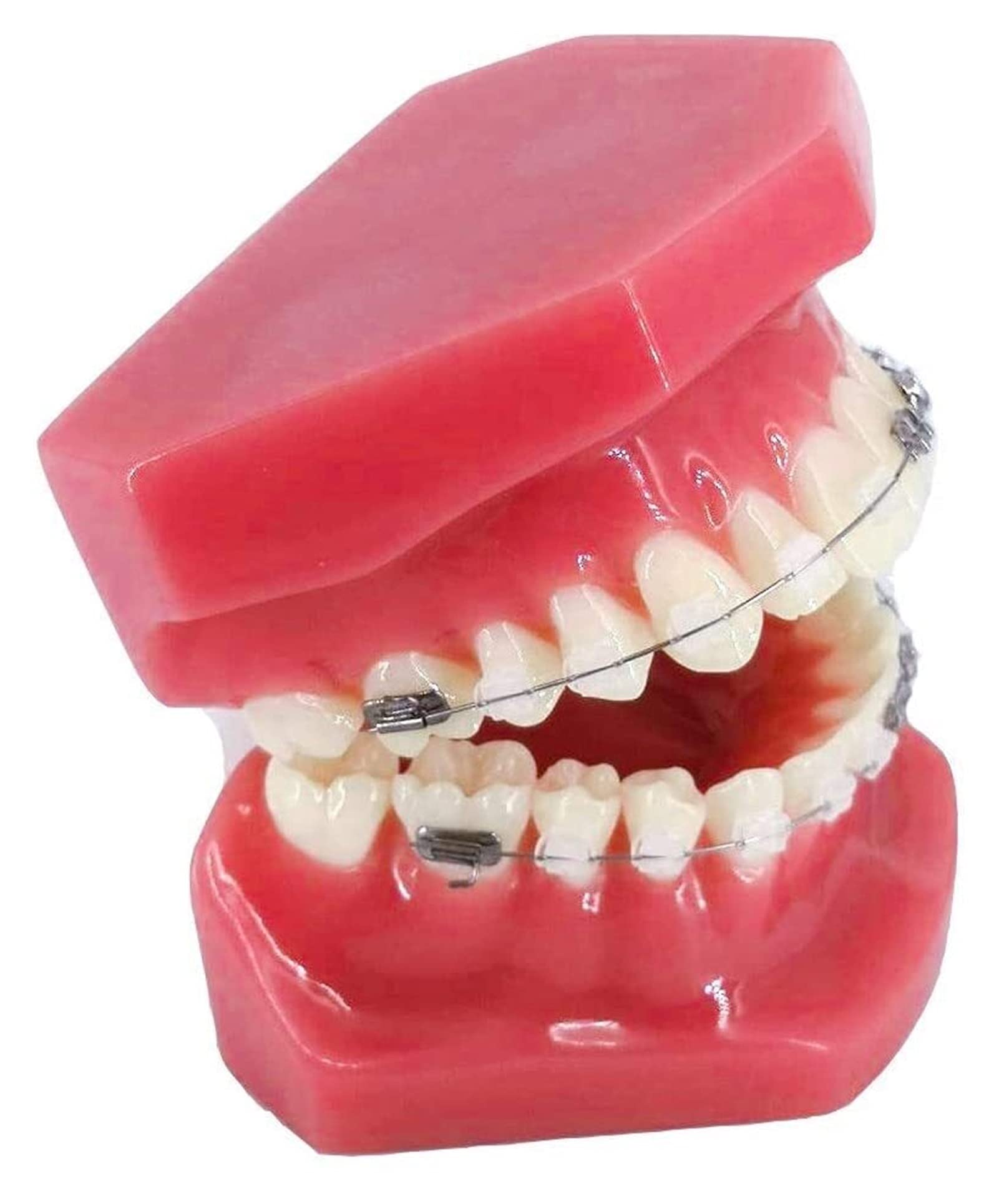 Modello di Organo Modello di Ortodonzia Dentale con Supporti in Metallo E Ceramica Orale Dimostrazione per Il Dentista per Comunicare con I Pazienti