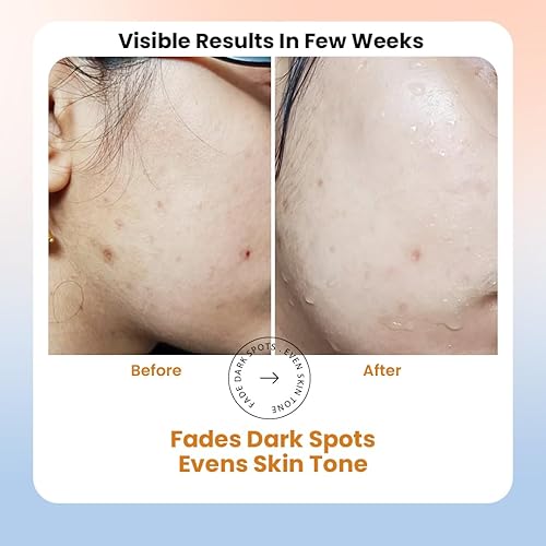 Miniatura 6 de Suero de vitamina C para cara con ácido hialurónico y ferúlico, aumenta el colágeno de la piel, hidrata y regordeta la piel, suero facial