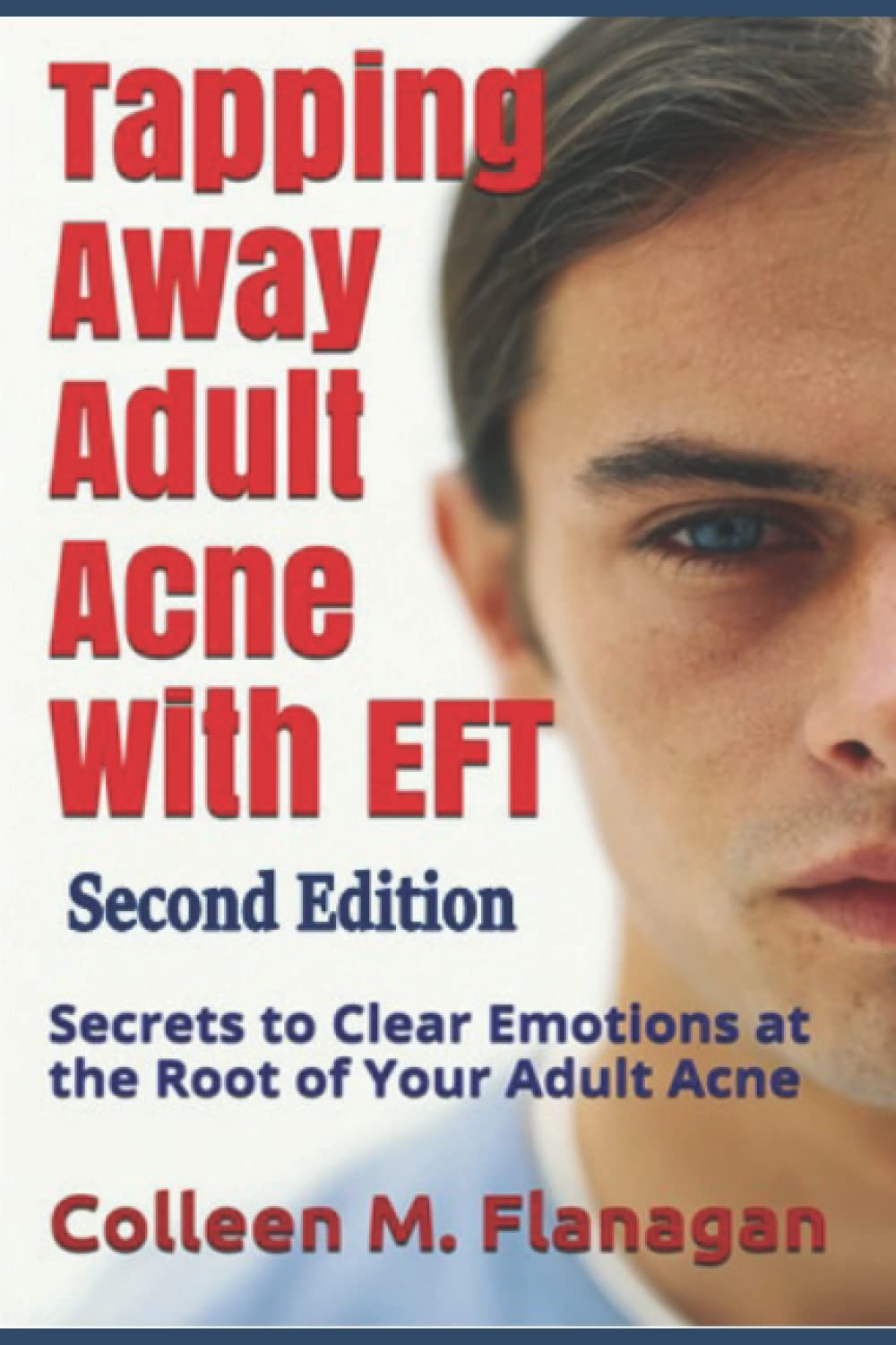 Tapping Away Adult Acne With EFT - Second Edition: Secrets to Clear Emotions at the Root of Your Adult Acne