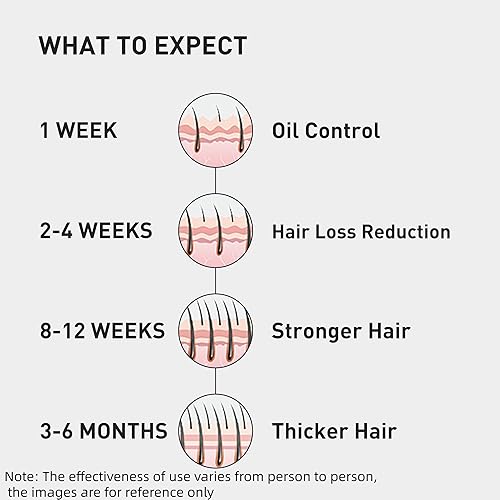 Miniatura 7 de 0.5% KINTOR KX-826 Spray para el crecimiento del cabello, control de aceite fortalece el cabello, productos para el crecimiento del cabello para