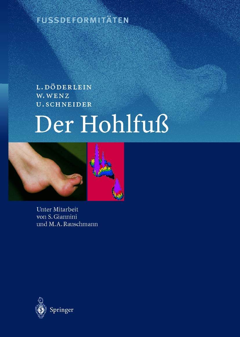Fussdeformitäten: Der Hohlfuss (German Edition)