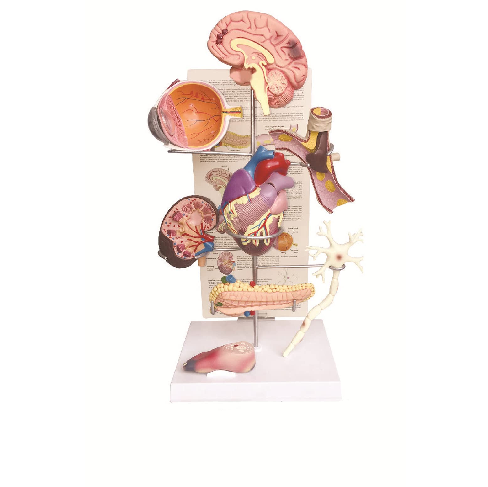 Modèle De Diabète Modèle Visuel Modèle D'hypertension Modèle De Diabète Cerveau, Oeil, Coeur Huit Organes