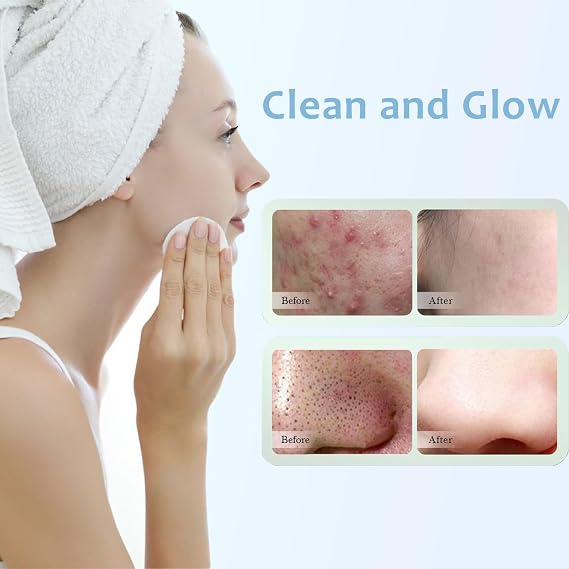 20% Glycolic Acid Facial Pads (60 Count),Exfoliating Resurfacing Pad for Face With Tea Tree Oil, Glycolic Acid Pads for Face Peel & Radiance Deep Cleaning Effect Radiant Skin Renewal