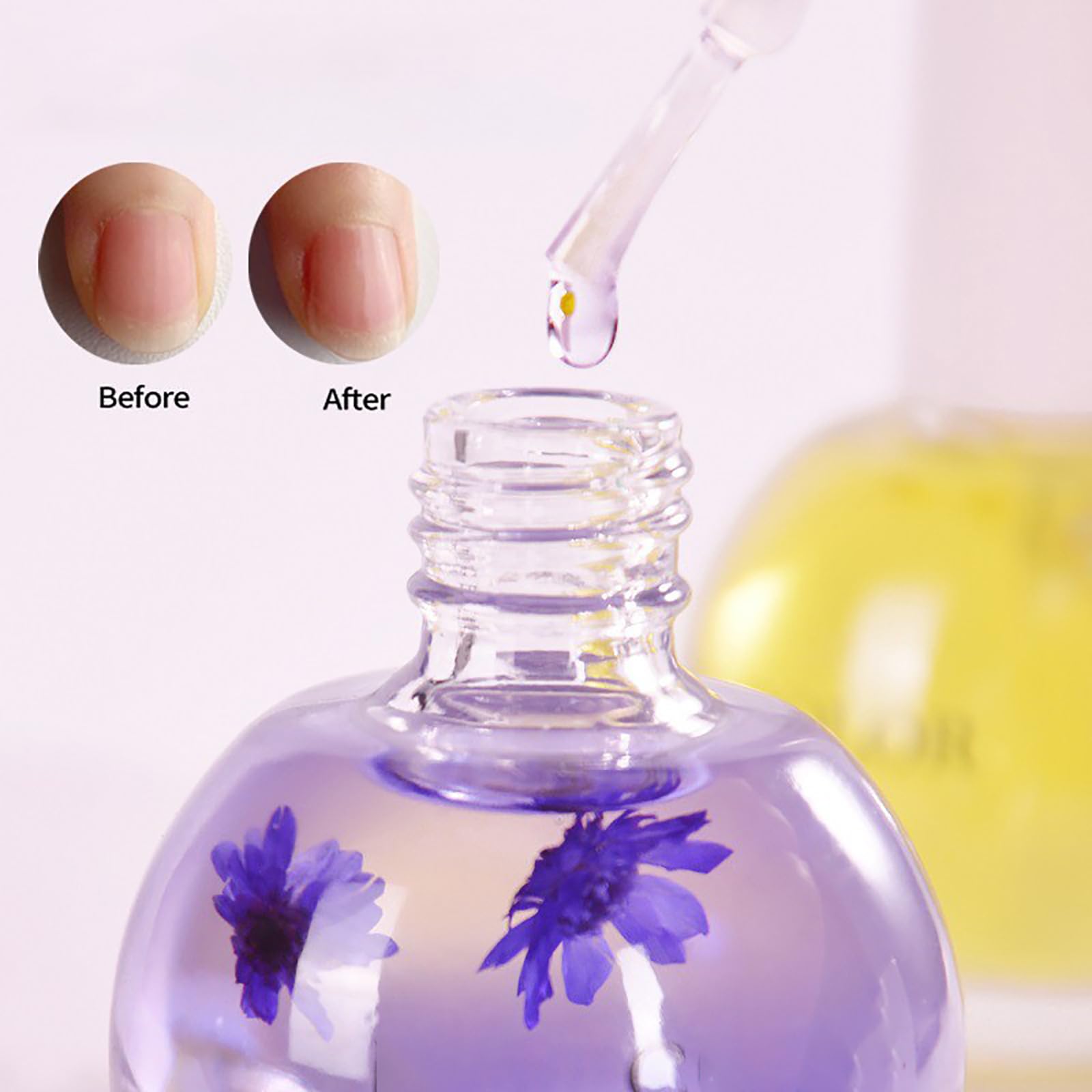 Set Di Olio Per Cuticole Al Profumo Con Fiori 15ml Olio Per Cuticole E Unghie Con Fiori Essiccati O-lio Nutriente Per Unghie E Cuticoles Con Vitamina B Ed E Idratante, Rigenerante