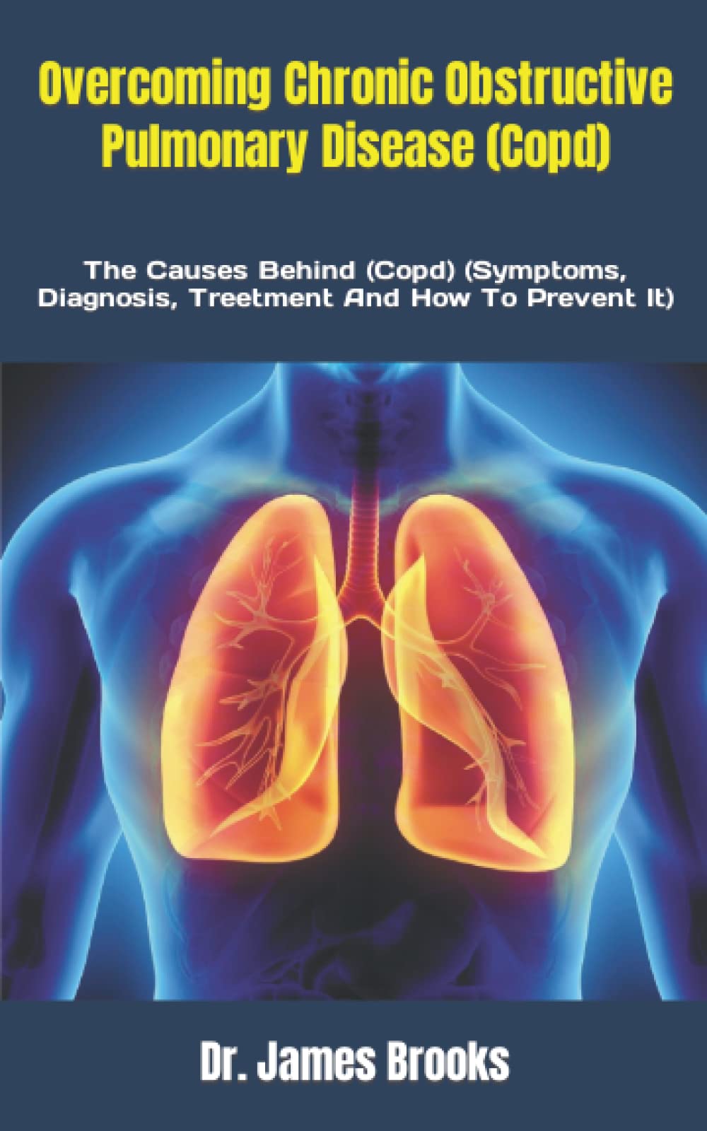 Buy Chronic Obstructive Pulmonary Disease (Copd) The Causes
