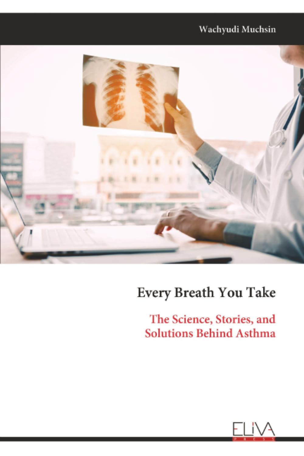 Every Breath You Take: The Science, Stories, and Solutions Behind Asthma