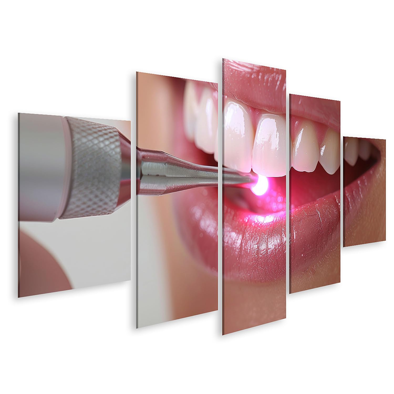 islandburner Quadro su tela sbiancante dei denti con tecnologia LED dal dentista per il bagno paziente studio dentistico Immagini da parete Poster