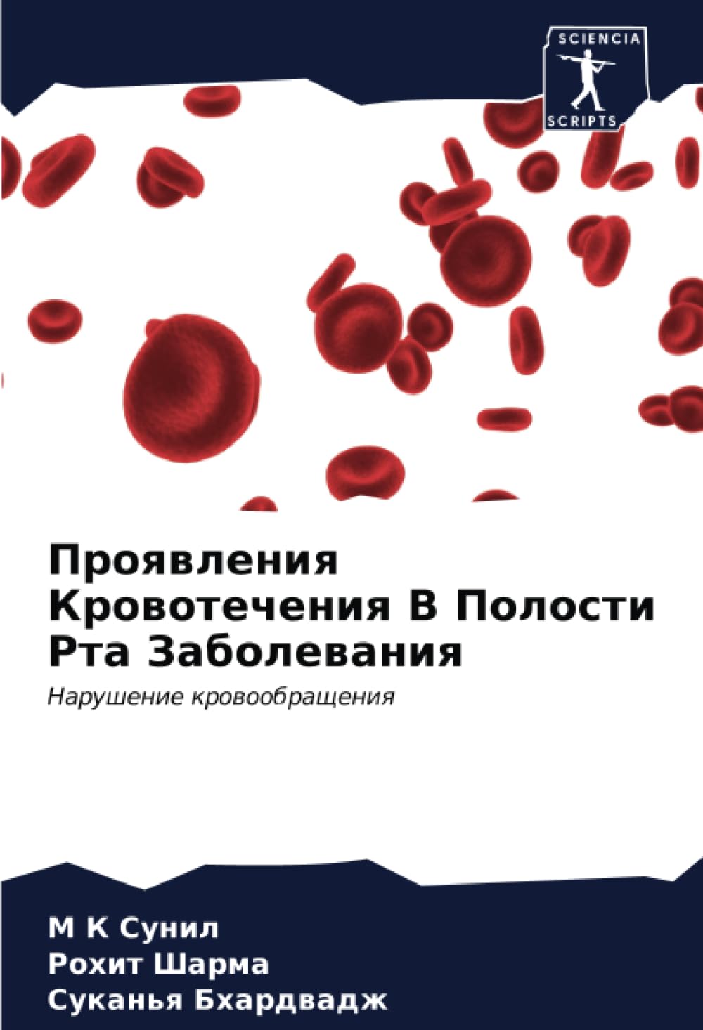 Проявления Кровотечения В Полости Рта Заболевания: Нарушение кровообращения: Narushenie krowoobrascheniq