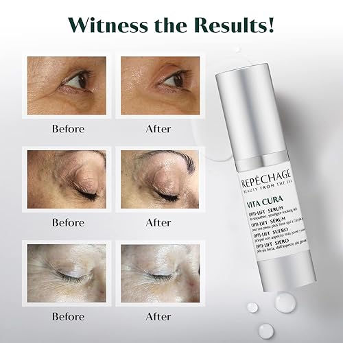 Miniatura 4 de Repechage Vita Cura Opti Lift Serum Instant Virtual Eye Contour Lifting Efecto para suavizar el aspecto de las arrugas de las patas de gallo con