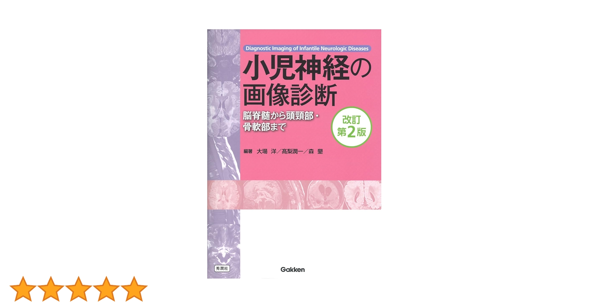 小児神経の画像診断 = Diagnostic Imaging of Infan… 小児神経の画像診断 改訂第2版: ―脳脊髄から頭頸部・骨軟部まで