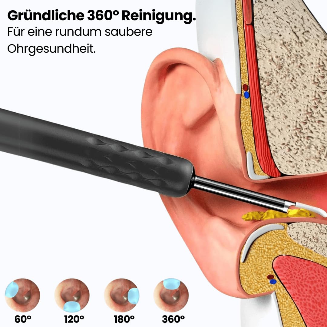 miluna pro - intelligenter ohrenreiniger mit hd-kamera Intelligenter Ohrenreiniger mit HD-Kamera – Effizienter Ohrenschmalz Entferner und Ohrenschmalz-Sauger für eine gründliche Ohrenreinigung
