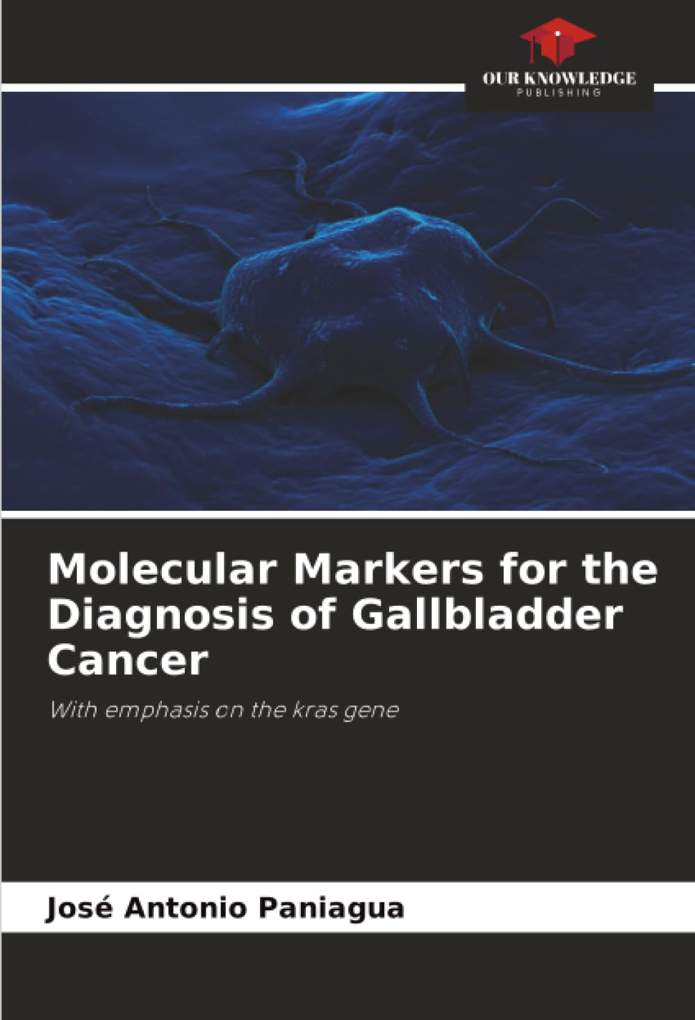 Molecular Markers for the Diagnosis of Gallbladder Cancer: With emphasis on the kras gene