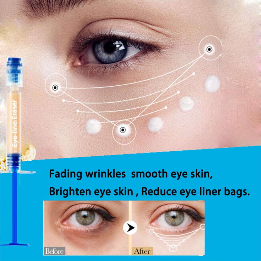 best treatment for eye bags