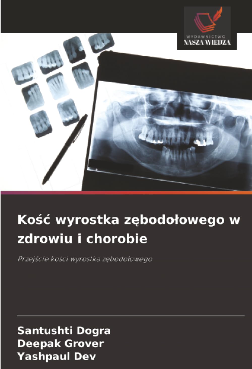 Kość wyrostka zębodołowego w zdrowiu i chorobie: Przejście kości wyrostka zębodołowego: Przej¿cie ko¿ci wyrostka z¿bodo¿owego
