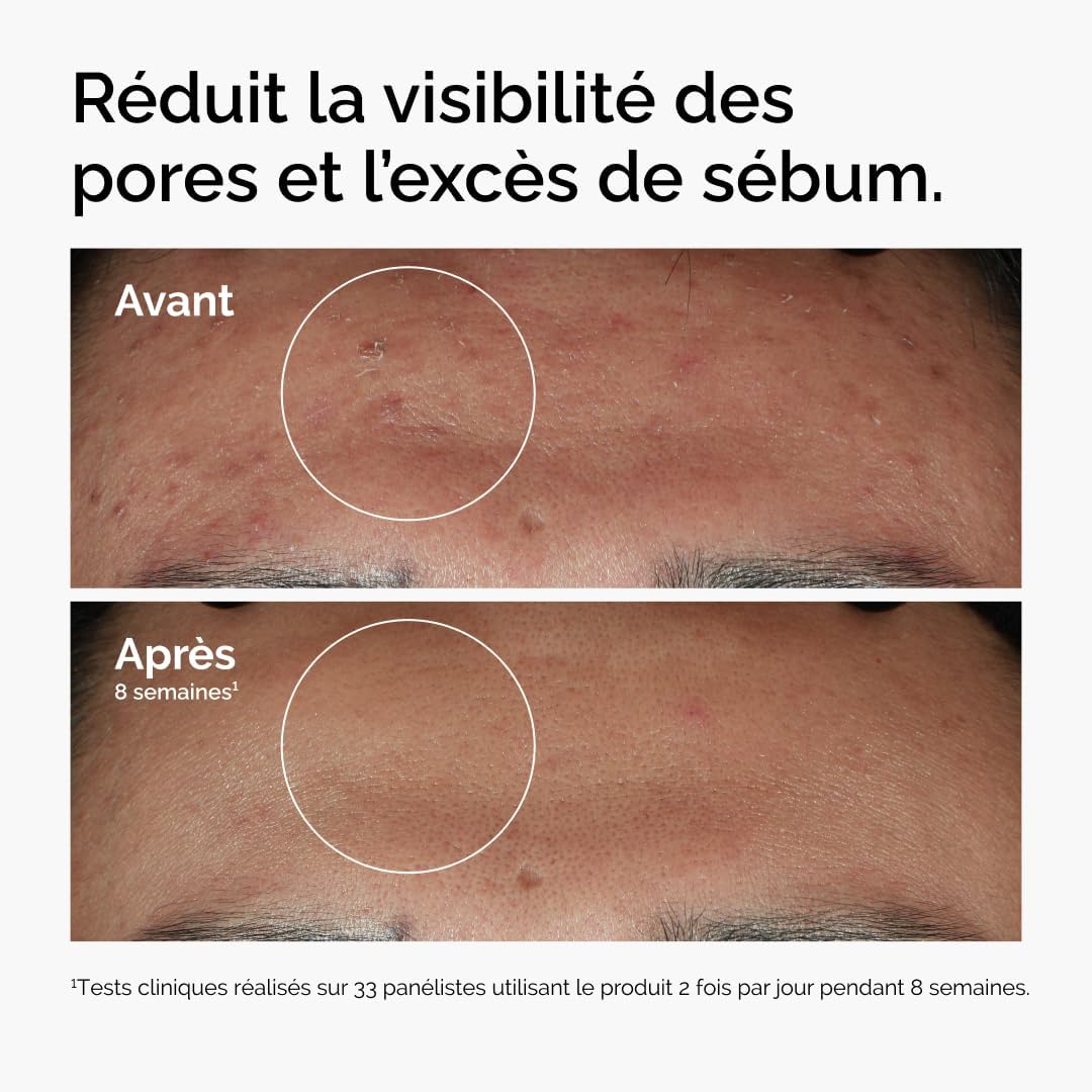 The Ordinary Niacinamide 10% + Zinc 1% – Sérum anti-imperfections, sébo-régulateur, éclat et pores affinés, 30 ml - Image secondaire