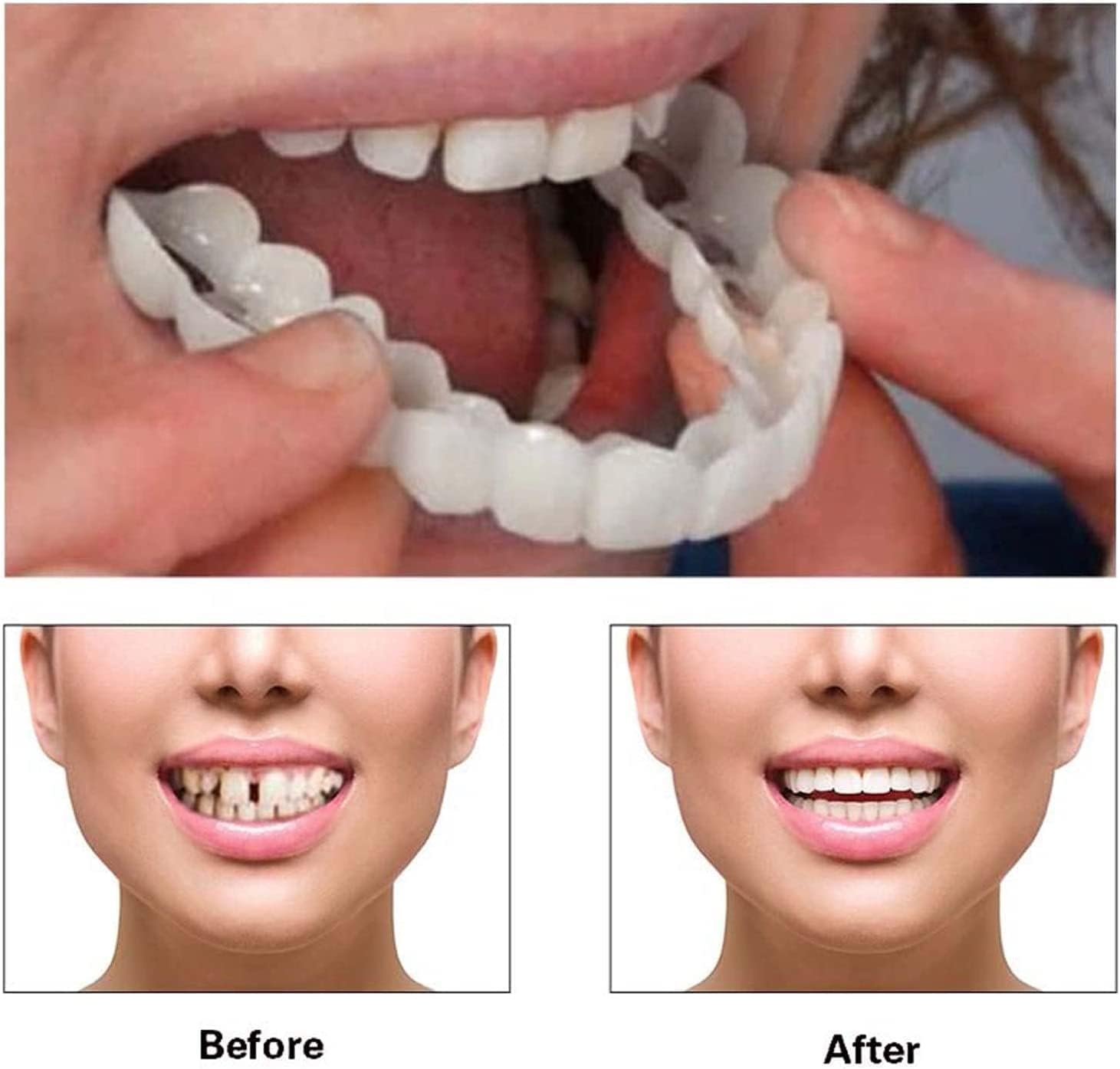 Buy Brace Cover Instant Smile Teeth Veneers Beautiful Smile Dentures