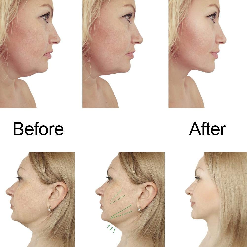Maschera a V per il viso, rassodante e idratante per il sollevamento del collo e del viso, cura del viso antietà con design a V