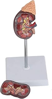 Study Model Educational Model Human Anatomy Science Models Human Kidney Anatomical Model PVC Renal Lesion Model for Medical School Student Training Aid,Medical Models SaiFei