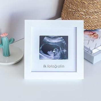 FUFIZU My First Photo Baby Ultrasound Frame - Baby Room Picture Memory Frame