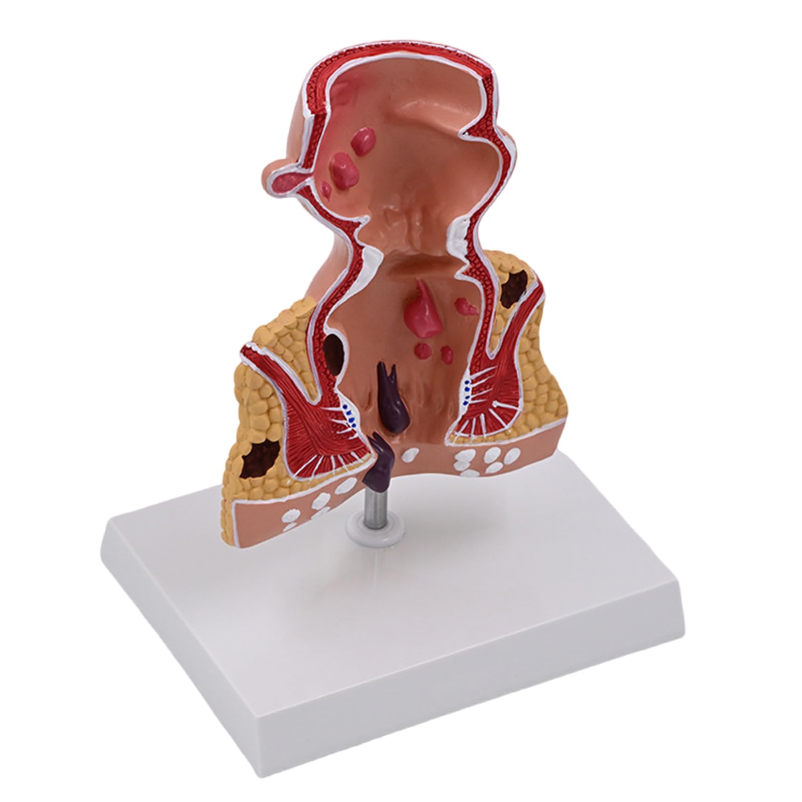 Modello retto per anatomia aiuto didattico patologie umane pratiche del retto modello di materiale scolastico umano per anatomia