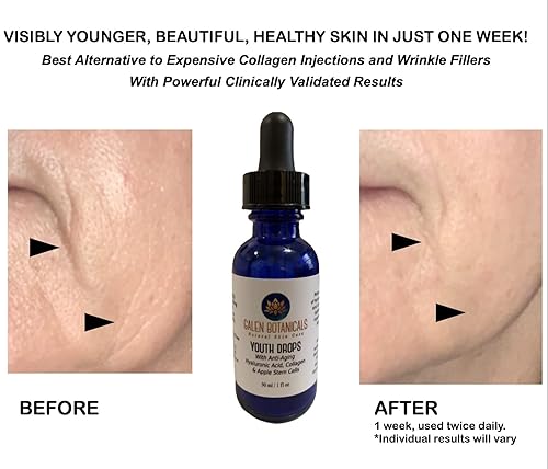 Miniatura 3 de Youth Drops Anti-Aging Face Serum - With Proven Collagen, Apple Stem Cells, Hyaluronic Acid - Reduces Wrinkles & Fine Lines - Doctor Formulated,