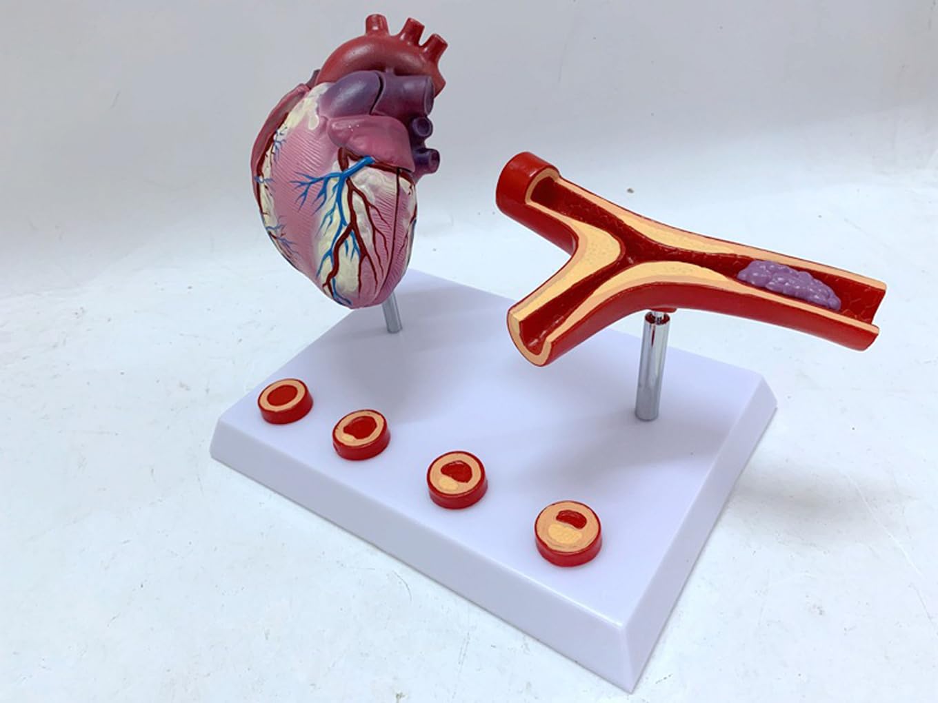 Narzędzia do nauki modelu, nauczanie anatomii serca serca pomostowanie tętnic wieńcowych model z blokadą tętnic i naczyń krwionośnych zakrzepica pomoce dydaktyczne