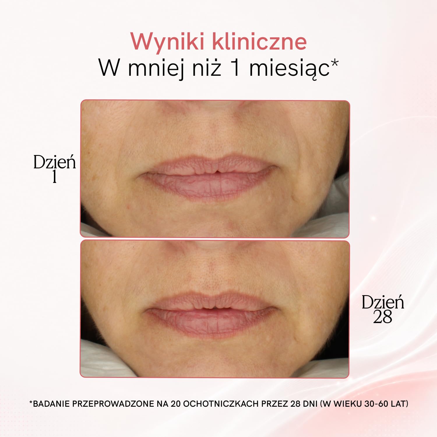 MASDERM | Urządzenie o częstotliwości radiowej twarz 5 w 1 | Elektryczny masażer | Czyszczenie | Profesjonalna maszyna Hifu do twarzy i ciała | Galwanika ujędrniająca