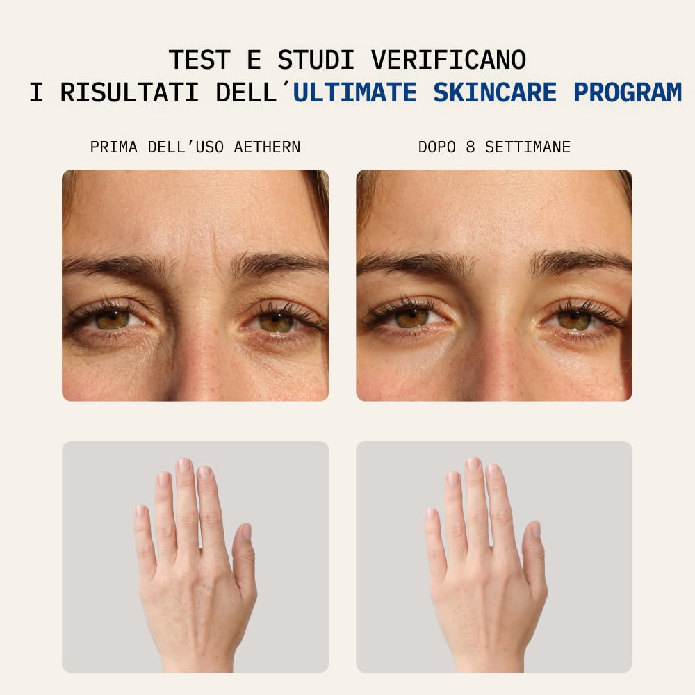 Ultimate Skincare Program - Integratore Liquido con Collagene + Acido Ialuronico per la Pelle. Pronto da Bere. Supporta Idratazione, Tonicità, Luminosità. 28 Fiale