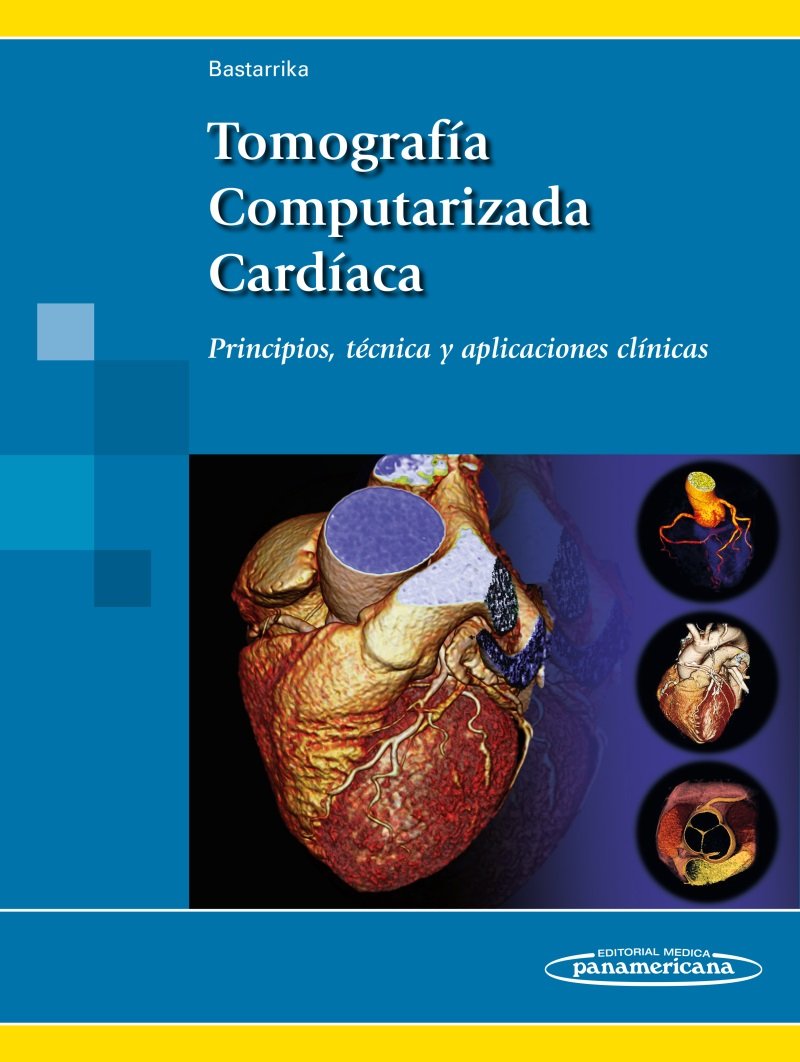 Tomografía Computarizada Cardíaca. Principios, técnica y aplicaciones clínicas