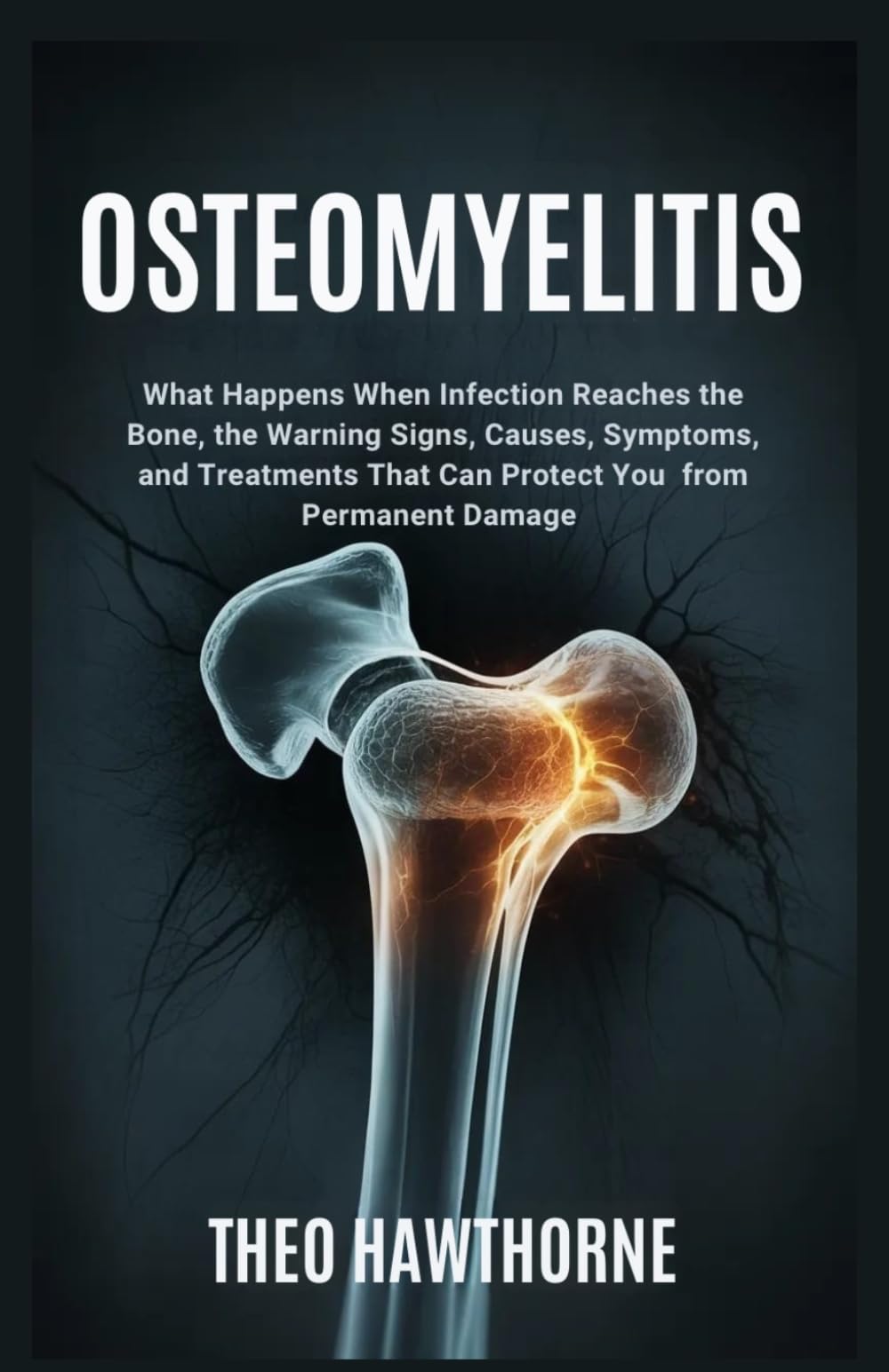 Osteomyelitis: What Happens When Infection Reaches the Bone, the Warning Signs, Causes, Symptoms, and Treatments That Can Protect You from Permanent Damage