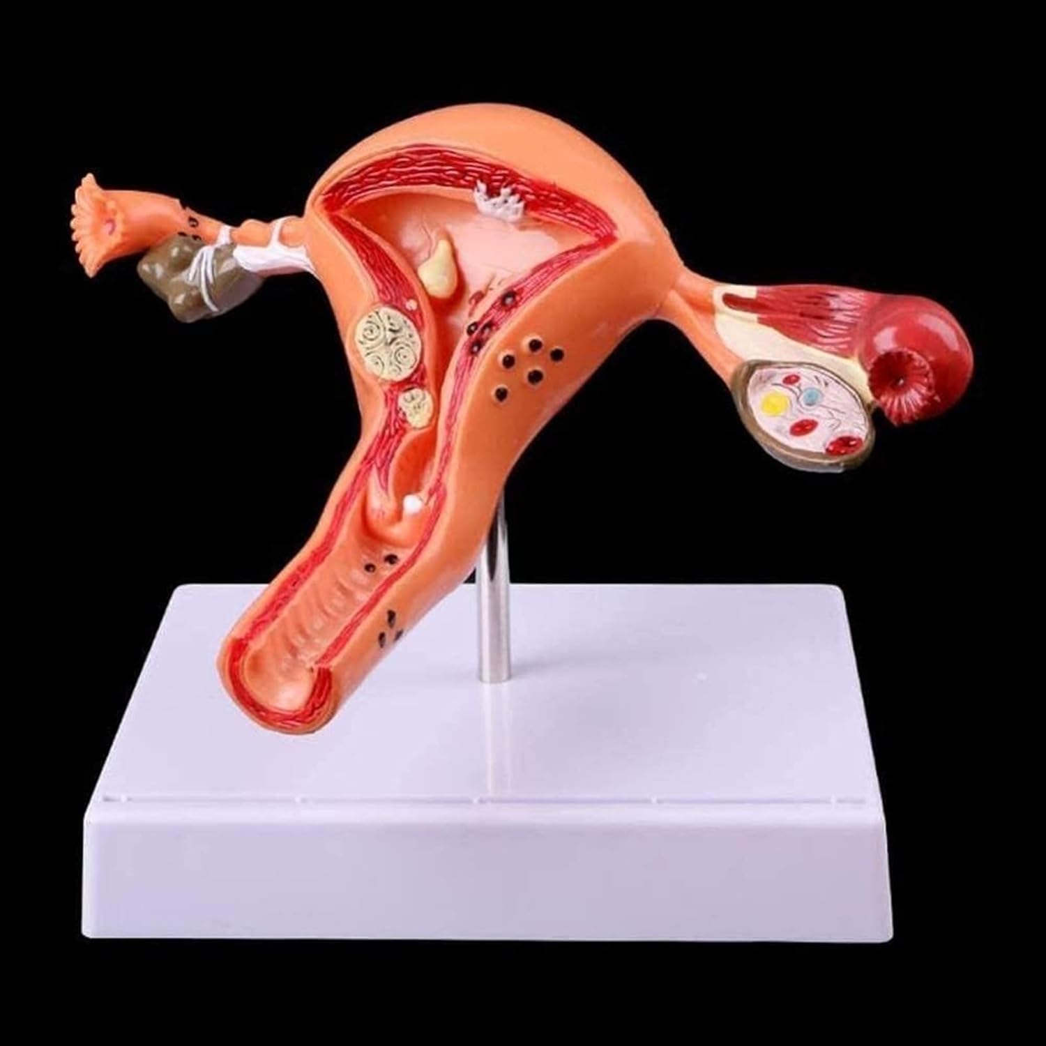 Modèle de pathologie de l'utérus féminin Humain Modèle d'anatomie de l'ovaire de l'utérus pathologique féminin Humain Modèle d'étude Anatomique en Coupe transversale
