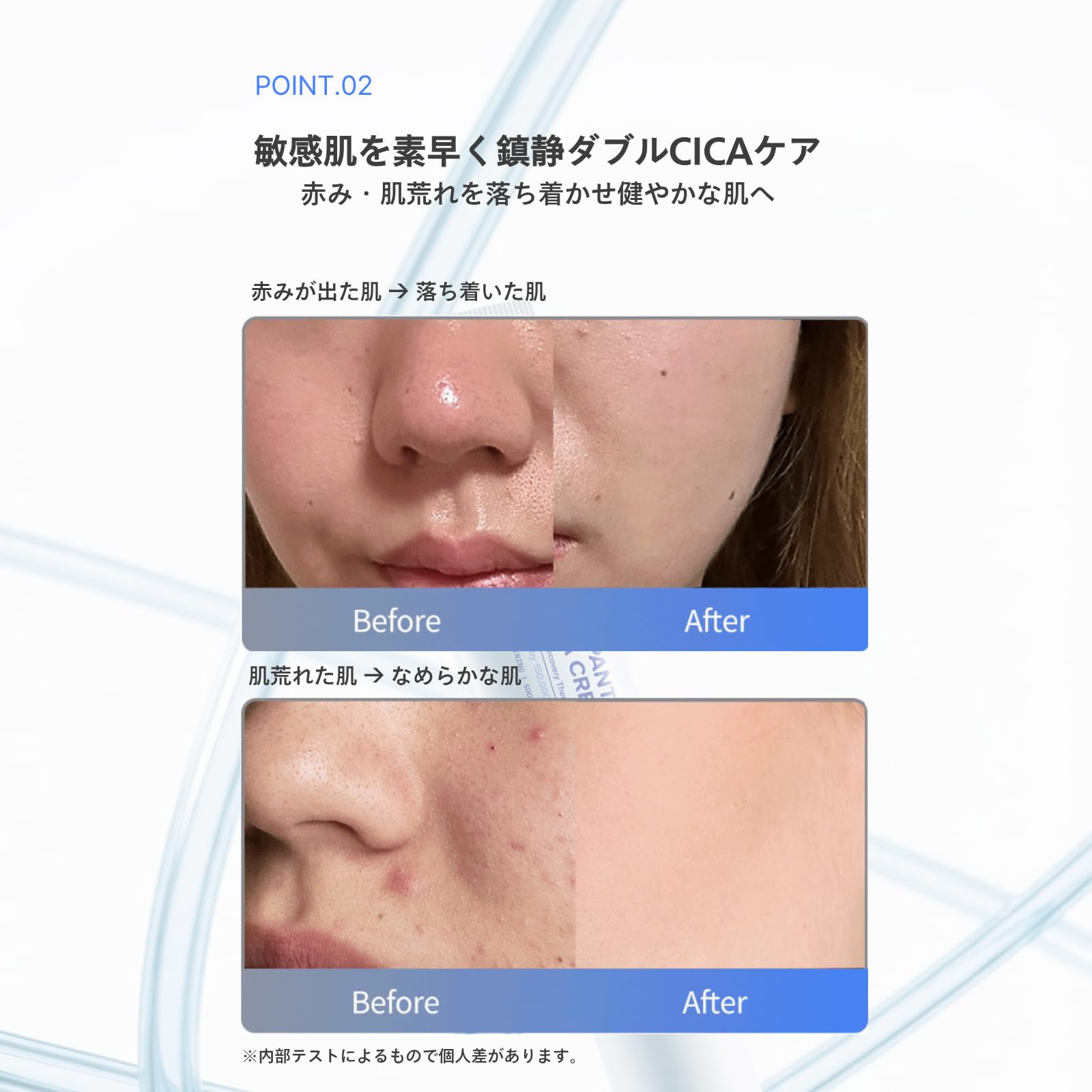 Amazon | ［公式］DEX PANTHENOL 15 CICA CREAM パンテノール15 シカ