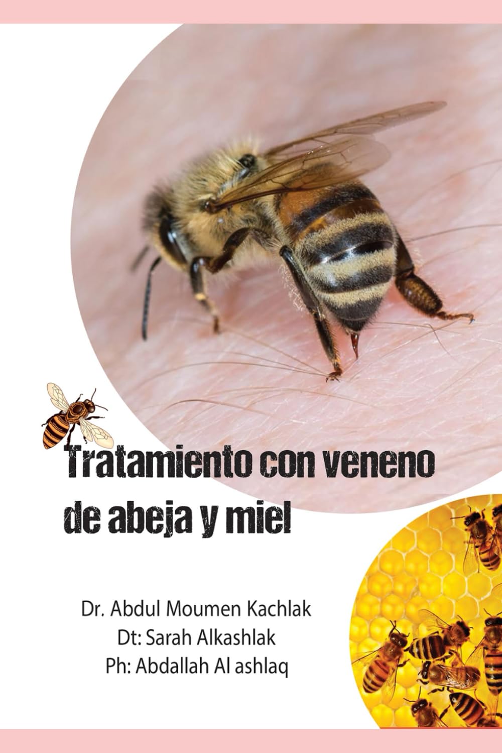 Tratamiento con veneno de abeja y miel