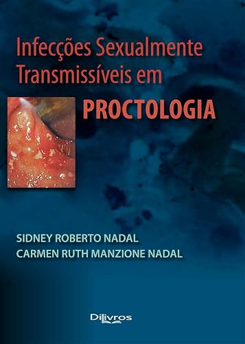 Infecções Sexualmente Transmissíveis em Proctologia