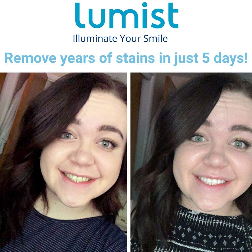 Lumist Advanced Teeth Whitening Strips with Comfort Fit Technology, 10 Strips