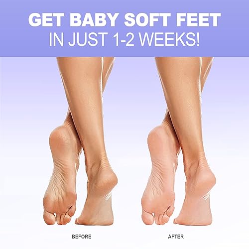 Miniatura 2 de Mascarilla exfoliante para pies, 3 pares, removedor exfoliante de callos para reparar talones agrietados y piel muerta y seca, para pies más suaves