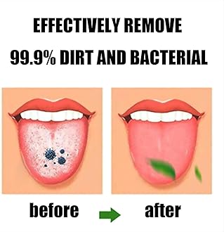 Tongue Scraper, Tongue Cleaner, Tongue Brushes Helps Fight Bad Breath, 2 Tongue Scrapers (Blue & Green & Orange & Red)