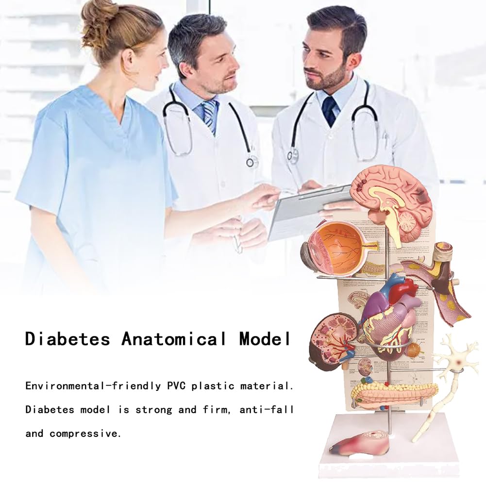 Modèle médical de diabète Modèle Anatomique de diabète Organe Humain Amovible Complications anatomiques du diabète Modèle d'affichage pour la médecine