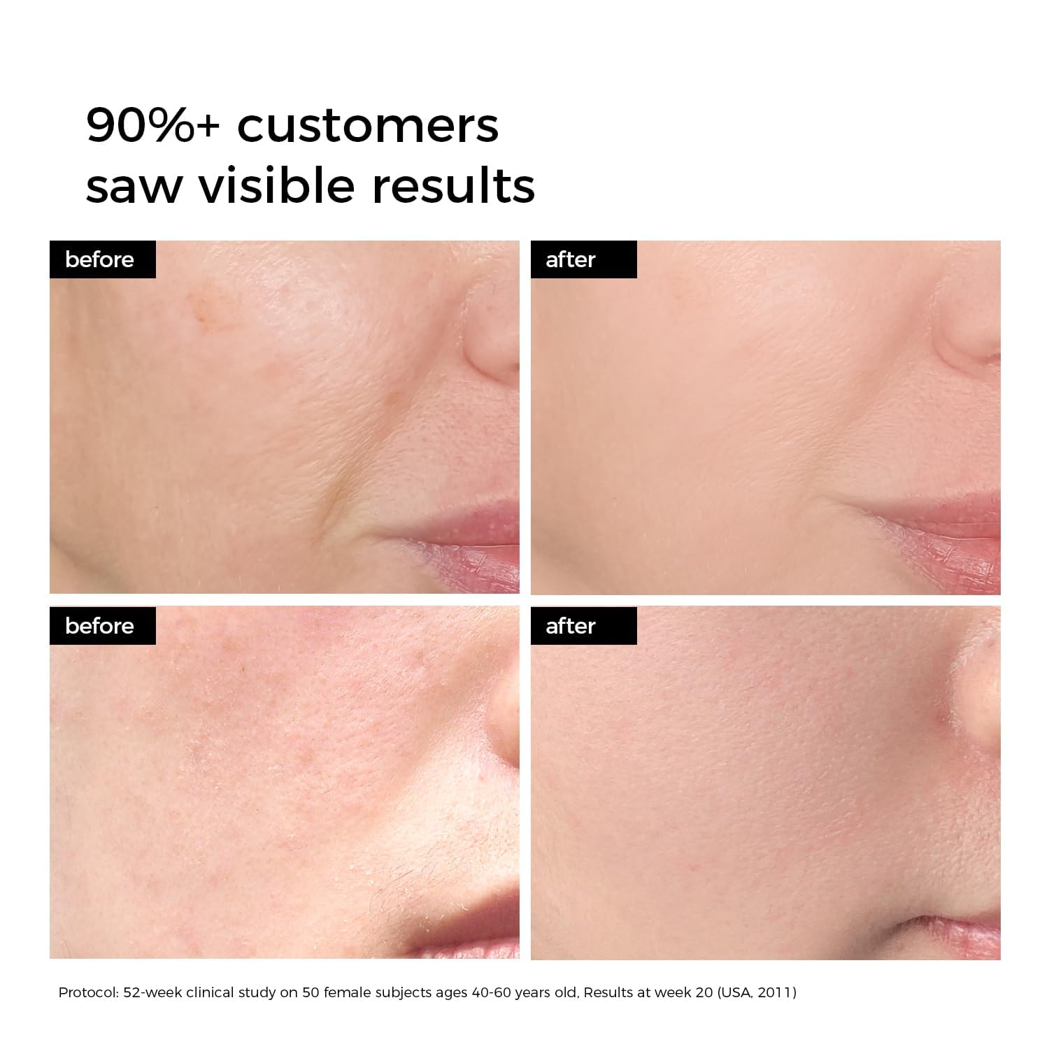 WNP 3 % Hyaluronsäure-Serum für das Gesicht mit 4D-Mehrschicht-Hydratation, ultra-feuchtigkeitsspendendes Anti-Aging-Serum, feuchtigkeitsspendend für trockene, empfindliche Haut