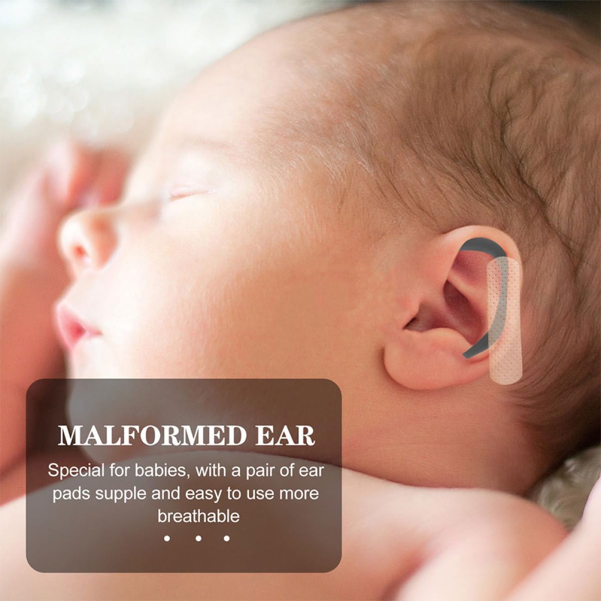 Correttore auricolare in silicone per neonati e bambini, correzione dell'orecchio sporgente per neonati e bambini, nero