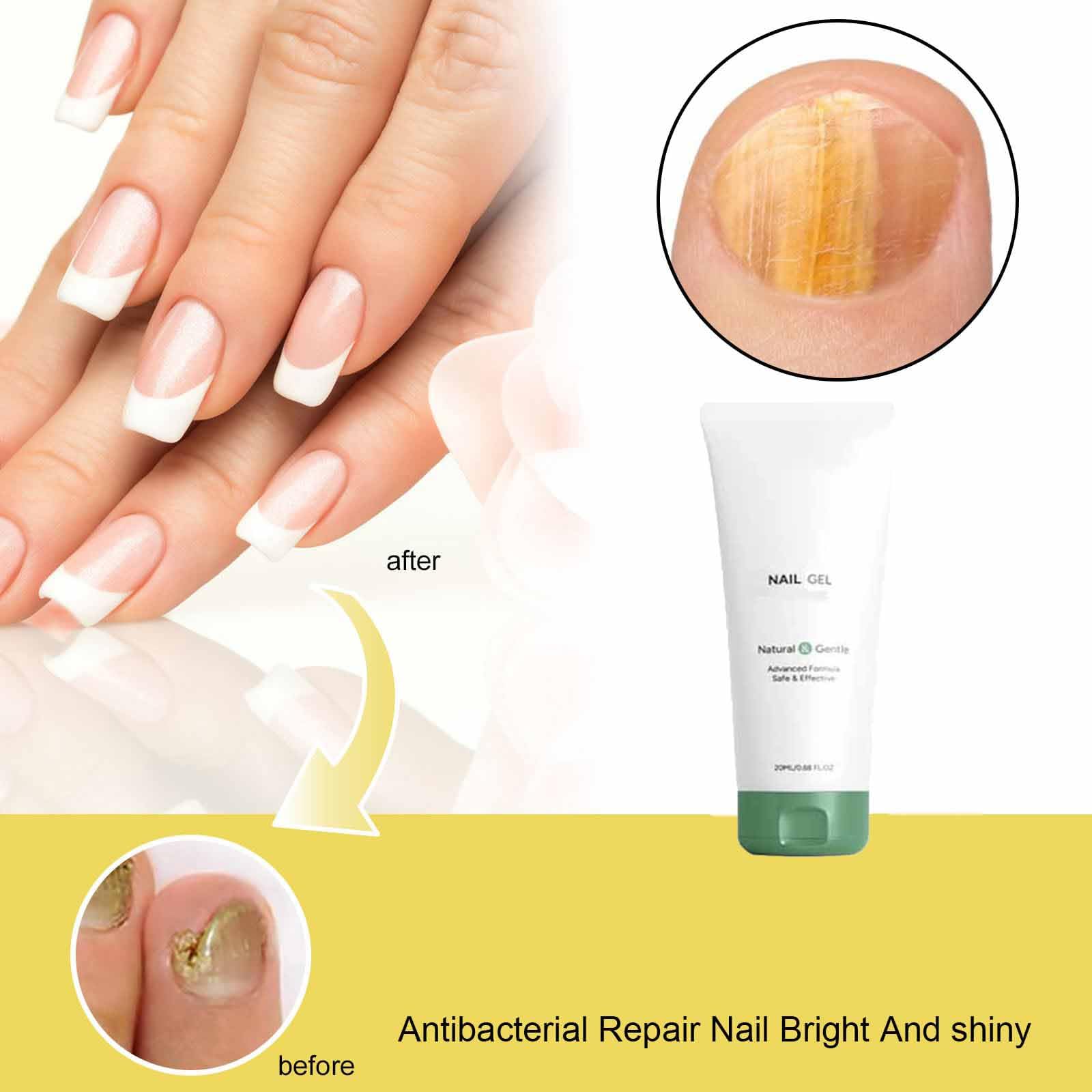 Nutraboost Nail Gel, Multi-Purpose Nail Repair