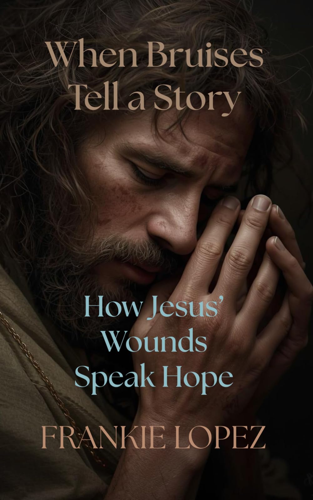 When Bruises Tell a Story: How Jesus’ Wounds Speak Hope