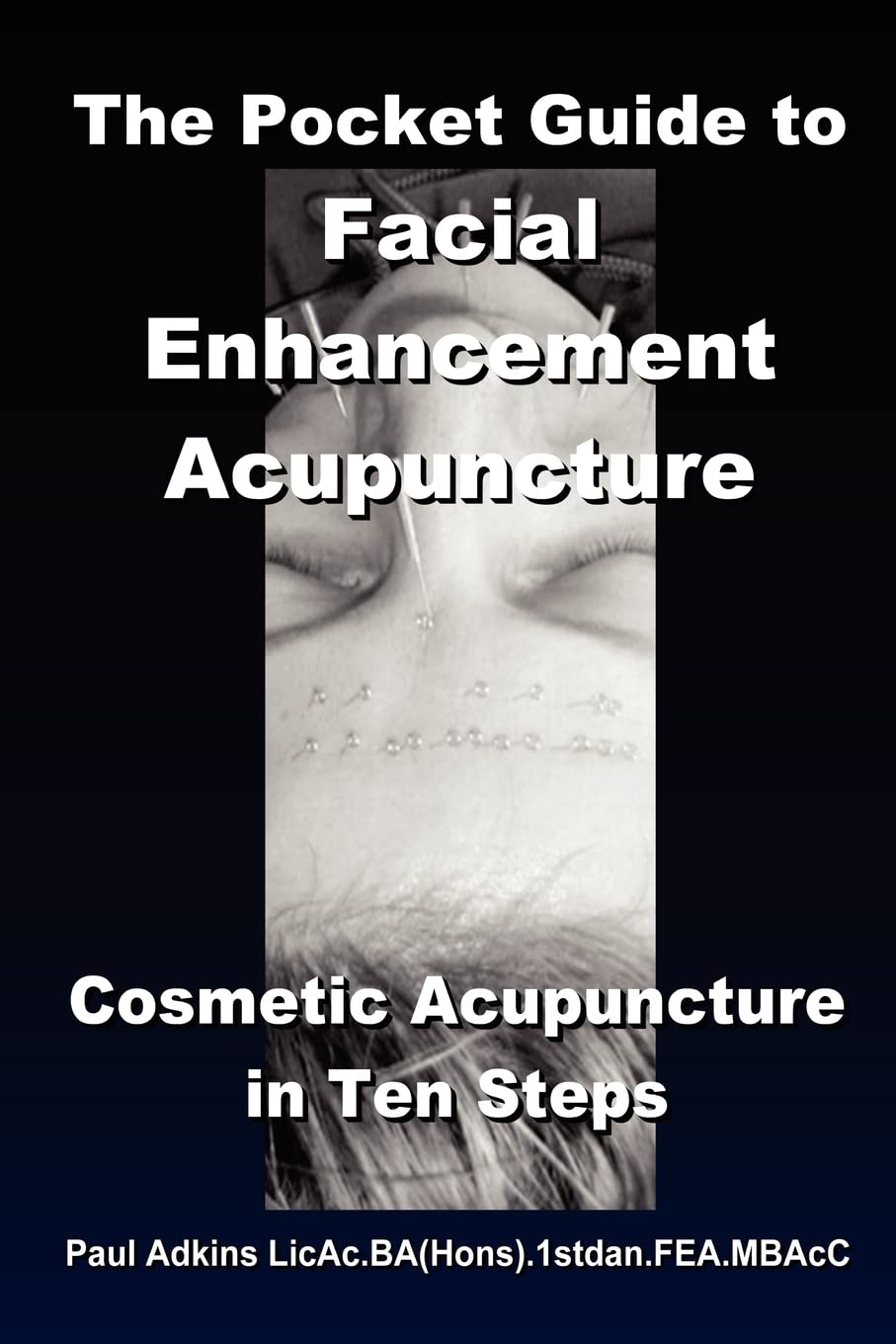 The Pocket Guide to Facial Enhancement Acupuncture: Cosmetic Acupuncture in Ten Steps