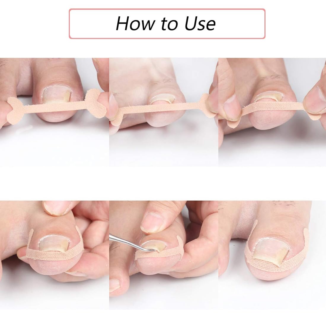 50 Foglio Correttore per Unghie Incarnite, Cerotti per Unghie, Unghia Incarnita Alluce, Unghie Incarnite Piedi, Strumenti per Pedicure, Cerotto per Unghia Incarnita