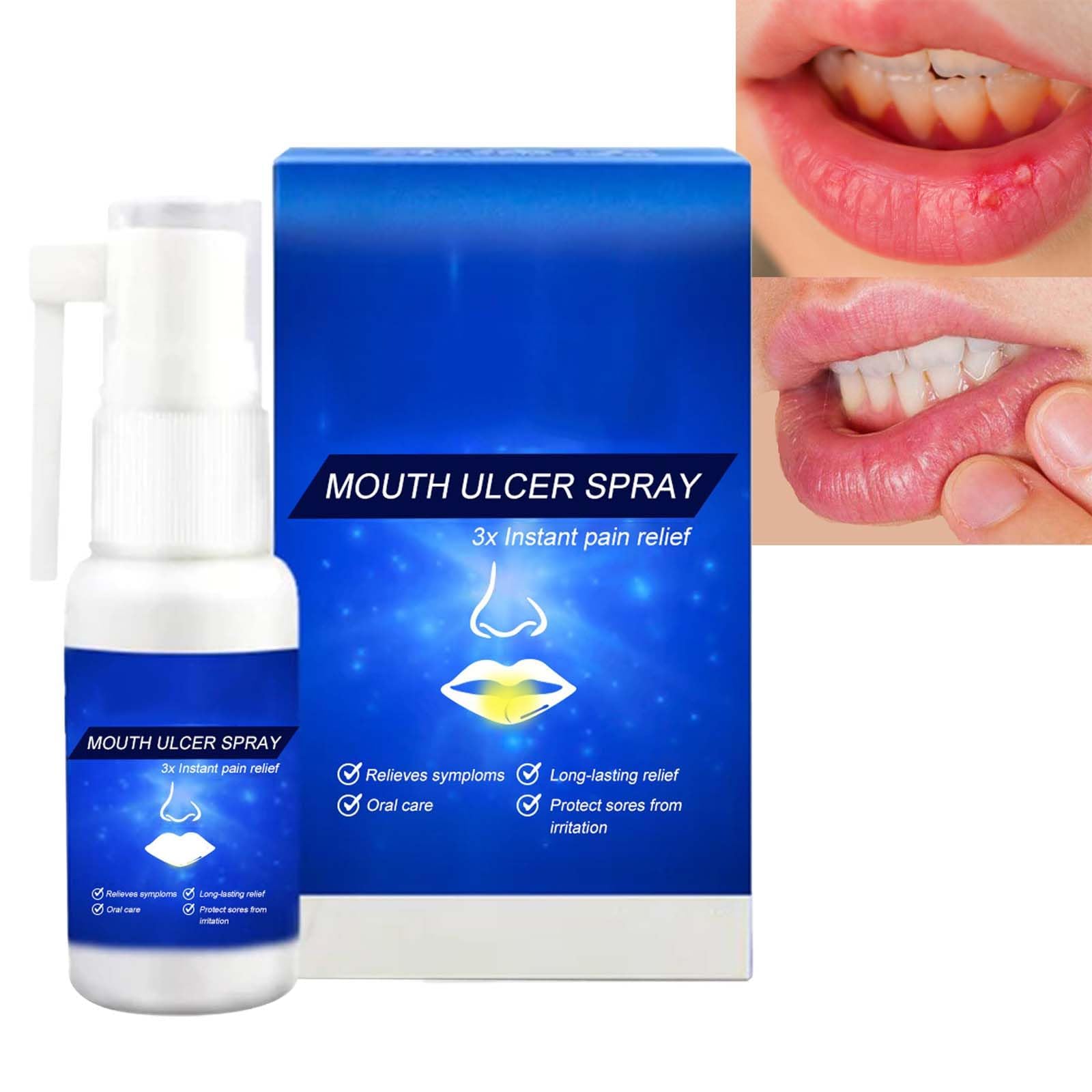 Mouth Ulcer Treatment Spray Gel for Adults, Dry Mouth Oral Ulcers Spray, Canker Sore Relief Spray for Fresh Breath