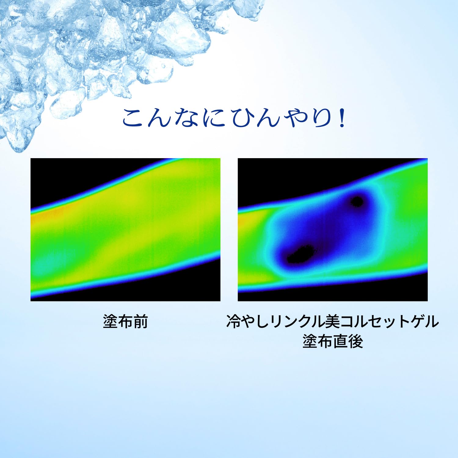 Amazon | プリオール オールインワンゲル 薬用 冷やしリンクル美