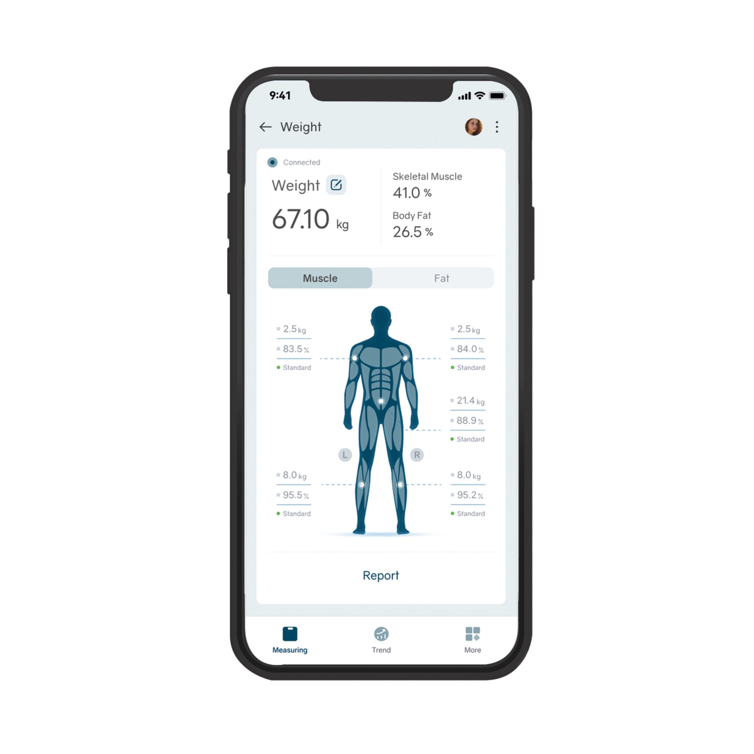 Salter Body Insight Smart Scale - Peso, Massa Grassa, Massa Muscolare, Massa Ossea, BMI, 8 Sensori ad Alta Precisione, Analisi dell'Impedenza Corporea Mano-Piede, Salter Balance App, LED, 180kg Bianco